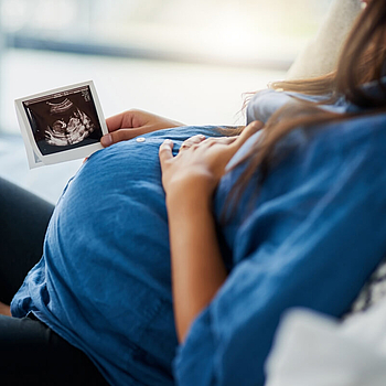 Eine schwangere Frau sitzt auf dem Sofa. In der rechten Hand hält sie ein Ultraschallbild ihres Babys.