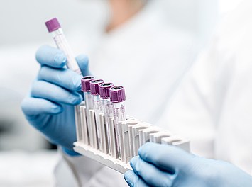 Eine Person hält mehrere Reagenzgläser in der Hand. Sie trägt einen weißen Kittel.