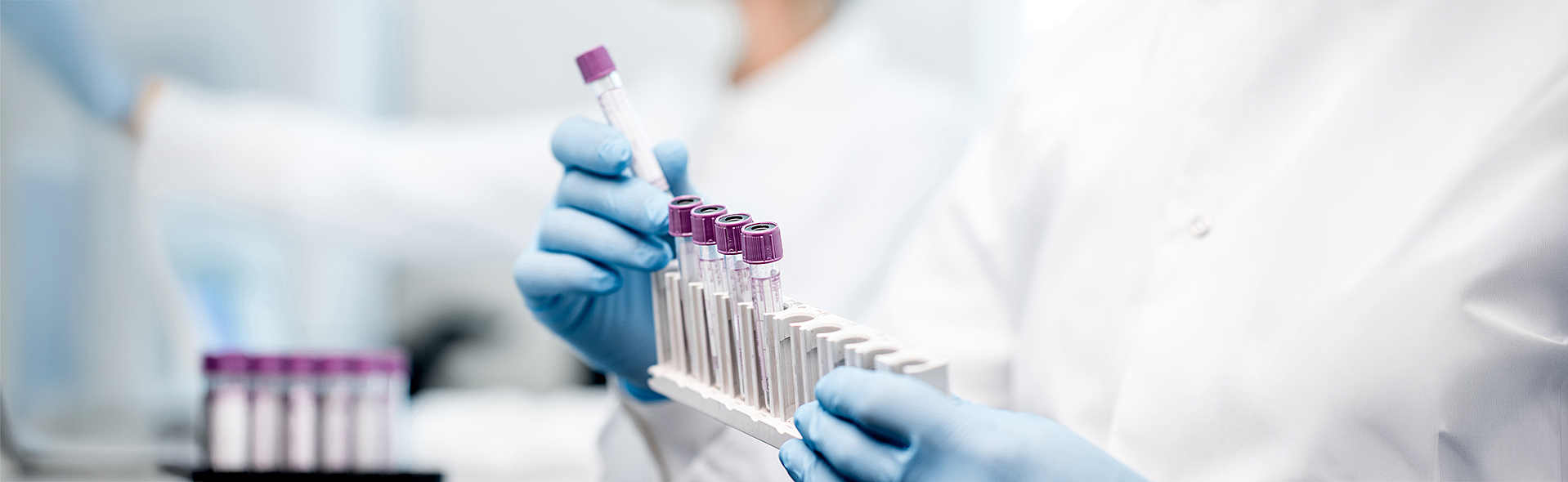 Eine Person hält mehrere Reagenzgläser in der Hand. Sie trägt einen weißen Kittel.