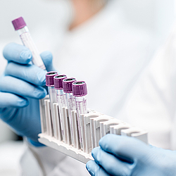 Eine Person hält mehrere Reagenzgläser in der Hand. Sie trägt einen weißen Kittel.