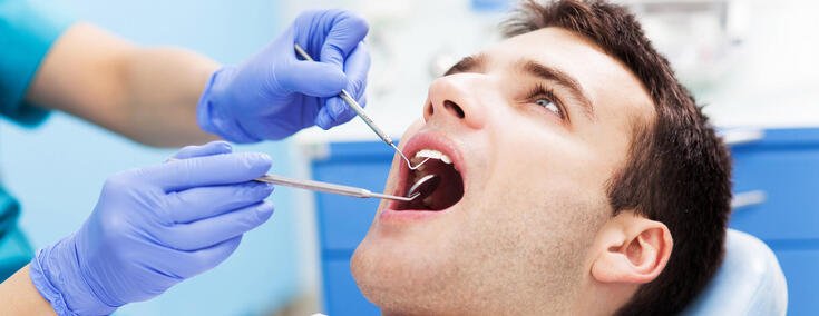 Mann mit offenem Mund bei der Zahnvorsorge