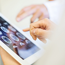 Ärzte sehen sich MRT-Aufnahmen auf einem weißen Tablet an.