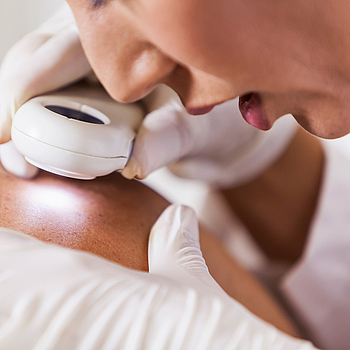Eine junge Ärztin schaut sich mit einem Dermatoskop die Muttermale auf einem Rücken an.