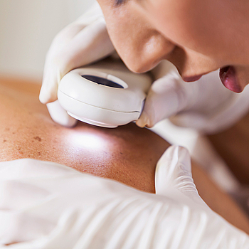 Ein Patient ist bei der Hautkrebsvorsorge. Eine junge Ärztin schaut sich mit einem Dermatoskop die Muttermale auf einem Rücken an.